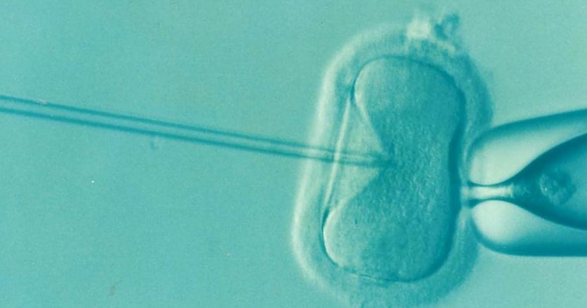 ‘You Can Even Name Your Embryo’: Genetics Startup Sells Test To Rank Embryos By IQ, Height And Looks